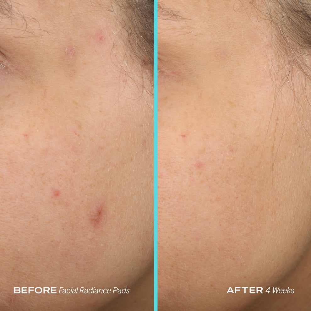 Facial Radiance Pads with Glycolic + Lactic Acids - Fab First And Beauty