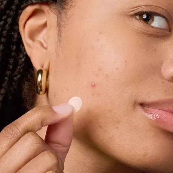 Blemish Backup Kit - Hero