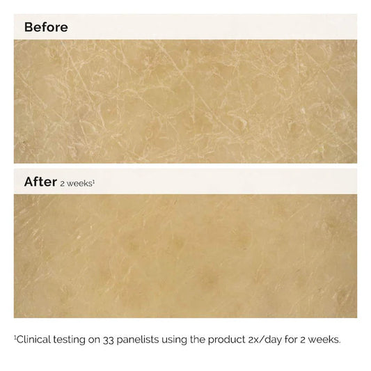 Body Care Natural Moisturizing Factors+Inulin Body Lotion - The Ordinary