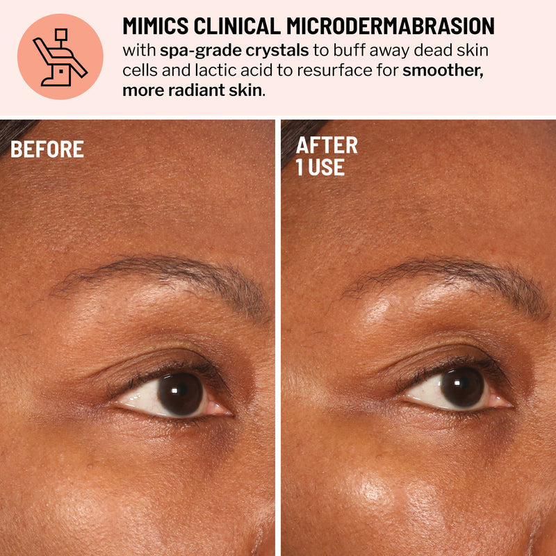 Advanced Micro Derma Brasion Face Exfoliator - Dr. Brandt