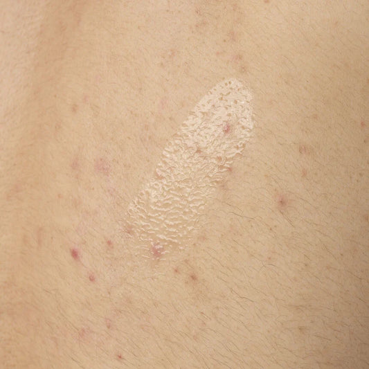 Salicylic Acid 0.5% Body Serum - The Ordinary Body Care