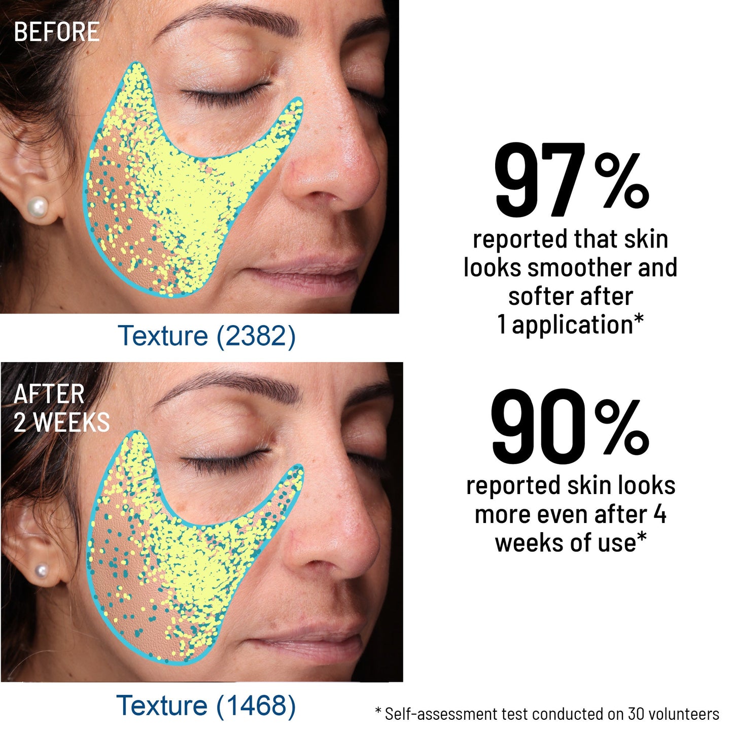 Advanced Micro Derma Brasion Face Exfoliator - Dr. Brandt