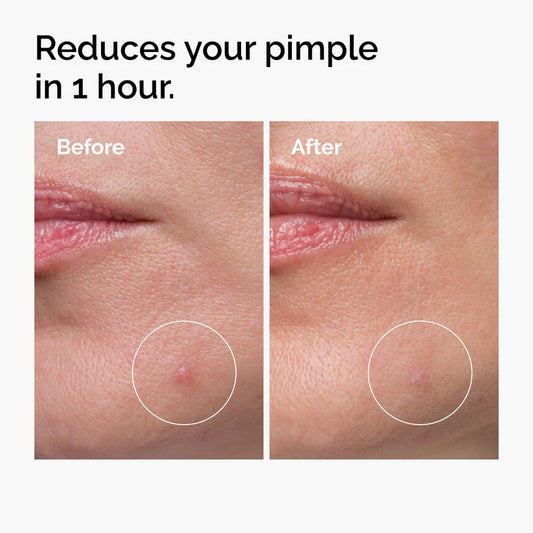 Sulfur 10% Powder to-Cream Concentrate - The Ordinary