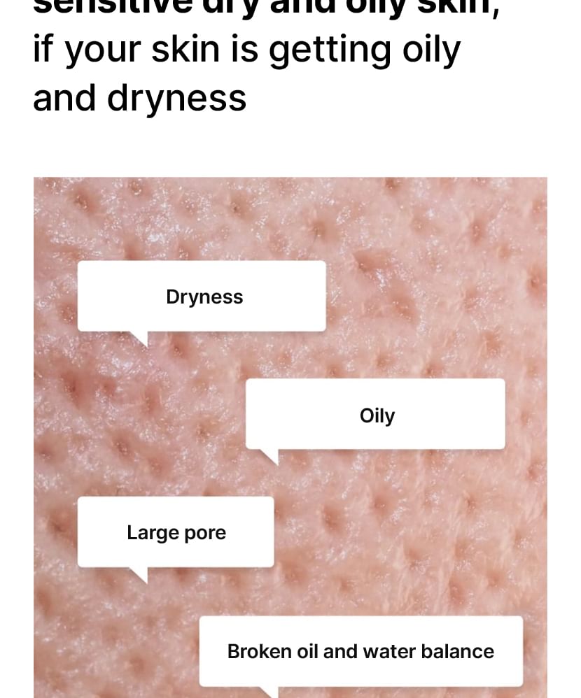 Oil Control Moisturizing Cream For Combination / Oily Skin - Celimax
