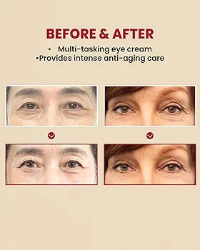 Seoul 1988 Eye Cream:Retinal Liposome 4%+Fermented Bean - K-Secret