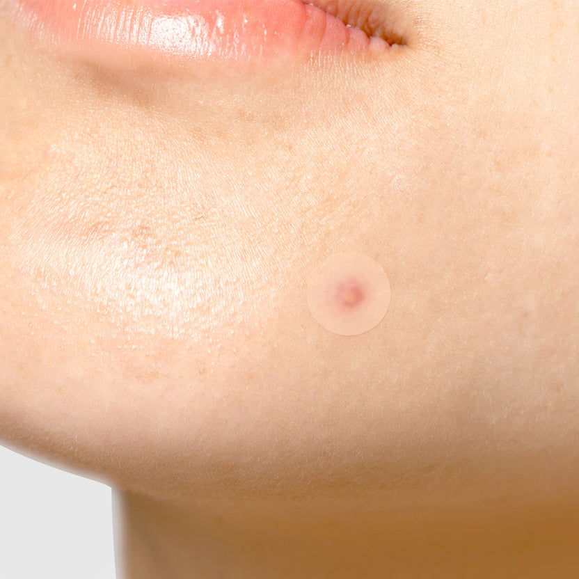 Surprises Patch H - Tiam