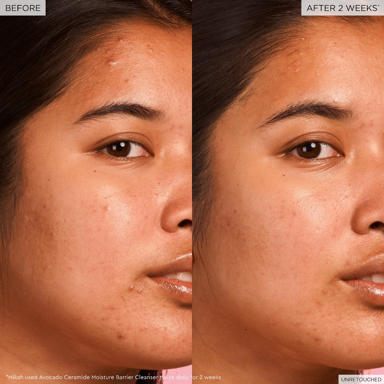 Avocado Ceramide Moisture Barrier Cleanser Glow Recipe