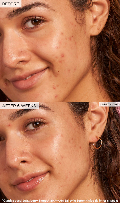 BHA + AHA salicylic Serum 30ml Glow Recipe