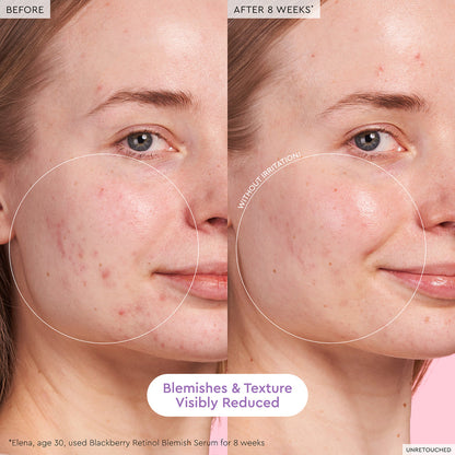 Blackberry Retinol Blemish Serum - Glow Recipe