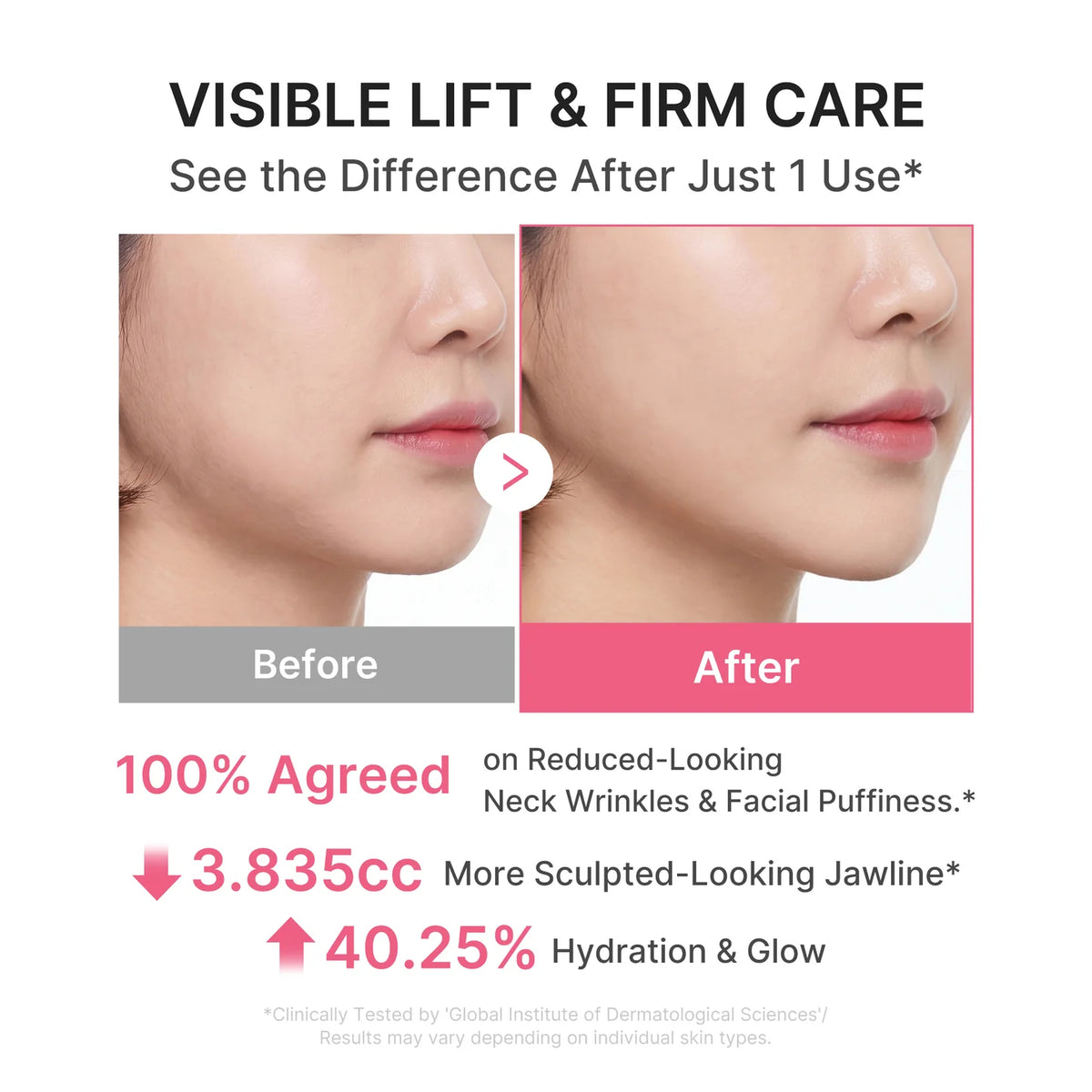 PDRN Collagen Gua Sha Neck Wrinkle Cream- Medicube