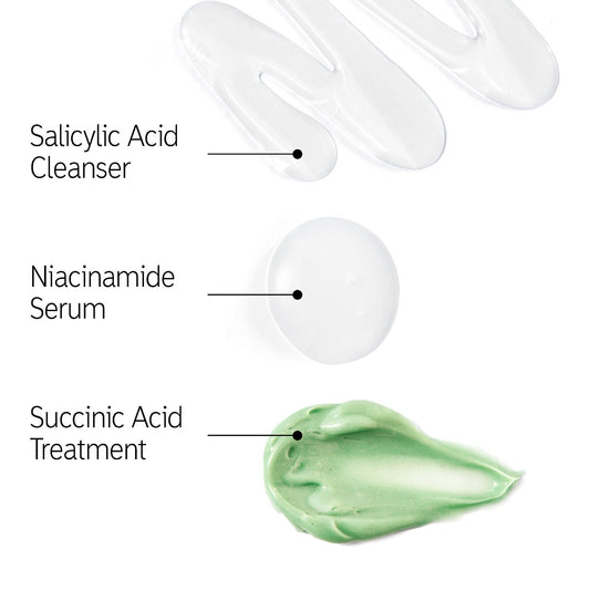 The Breakout Set : The Inkey list