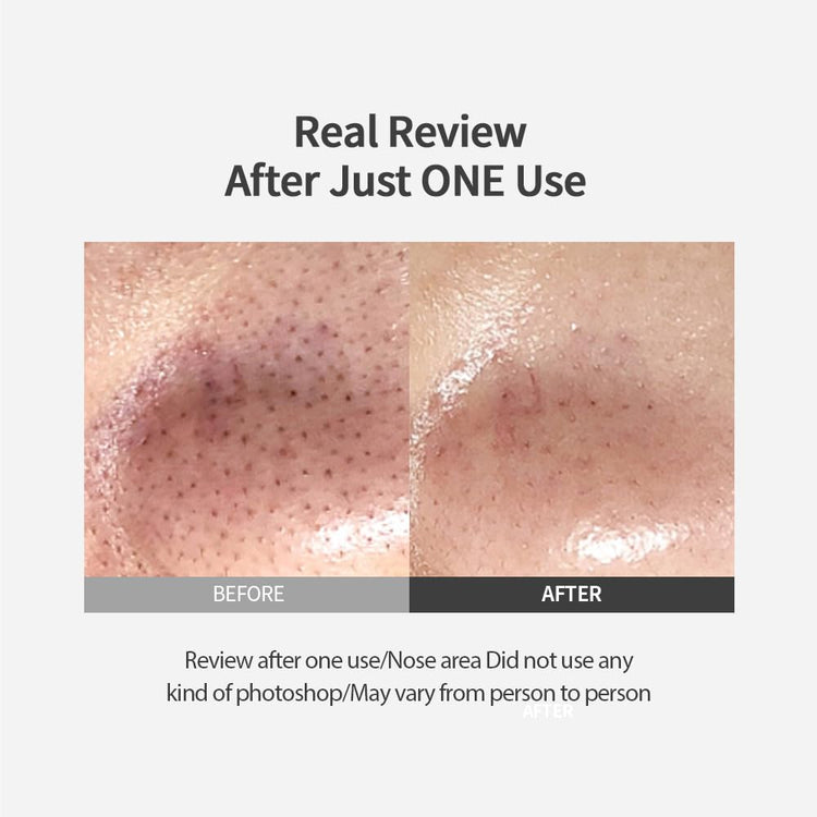 Dead Sea Salt LHA Blackhead Melting Out Pad - Sungboon Editor