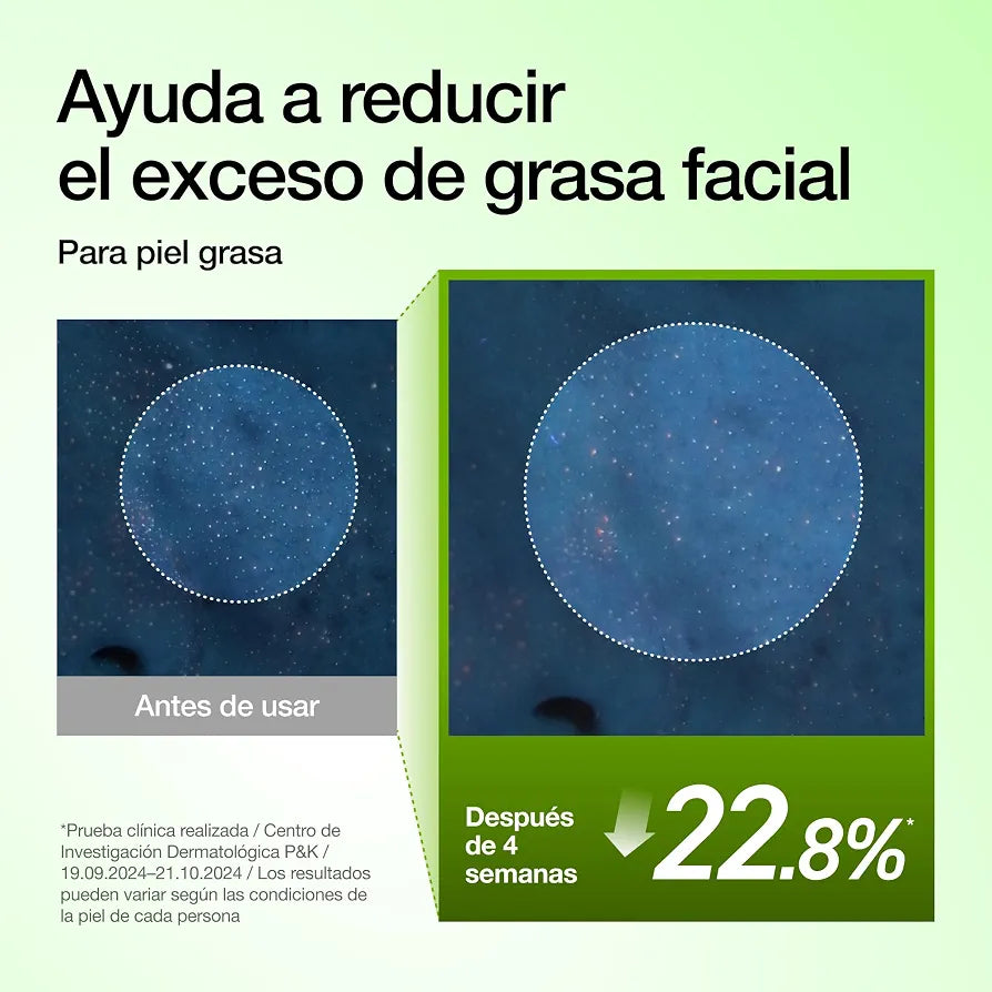 Azelaic Acid 10 Hyaluron Redness Serum -Anua