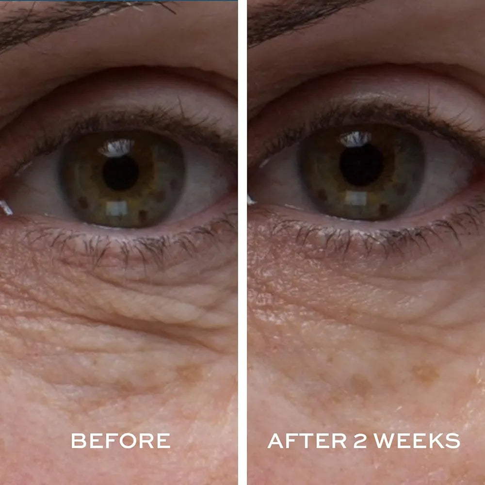 Peptide 4 Eye Recovery Cream - Elemis