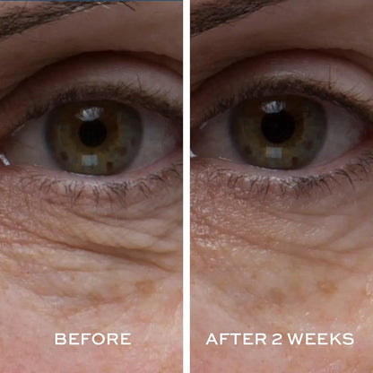Peptide 4 Eye Recovery Cream - Elemis