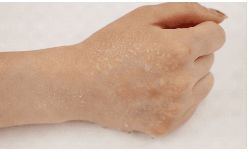 Spot Patch Cica x Care - Vt Cosmetics