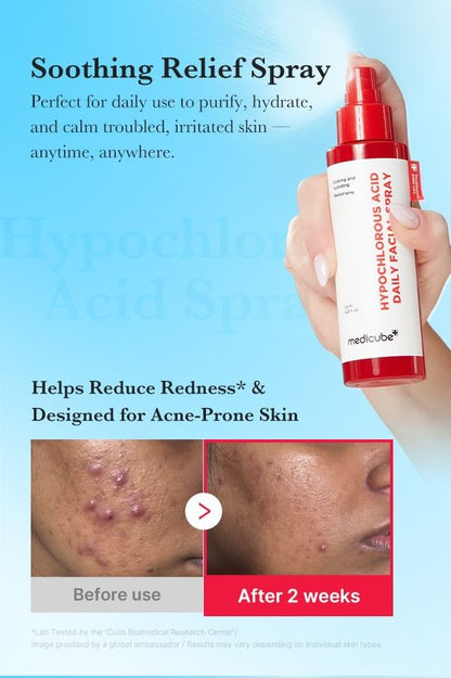 Hypochlorous Acid Daily Facial Spray - Medicube