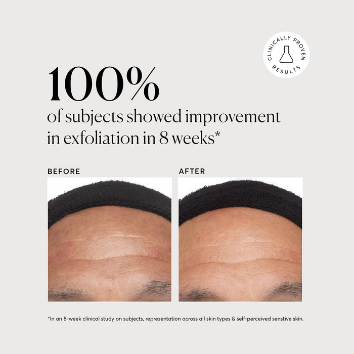 Azelaic Topical Acid 10% - Naturium