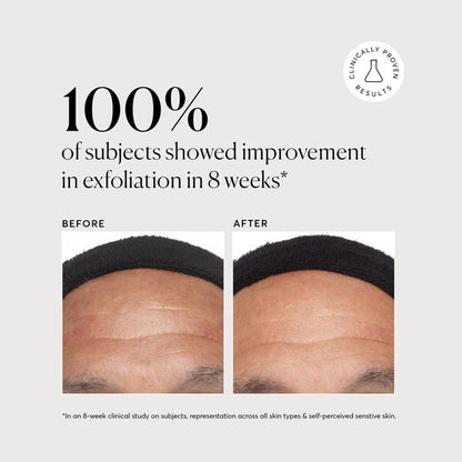 Azelaic Topical Acid 10% - Naturium