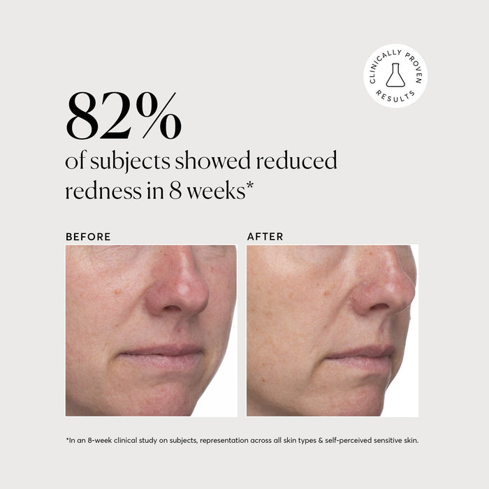 Azelaic Topical Acid 10% - Naturium