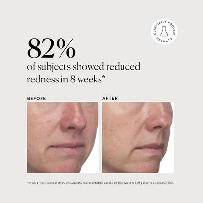 Azelaic Topical Acid 10% - Naturium