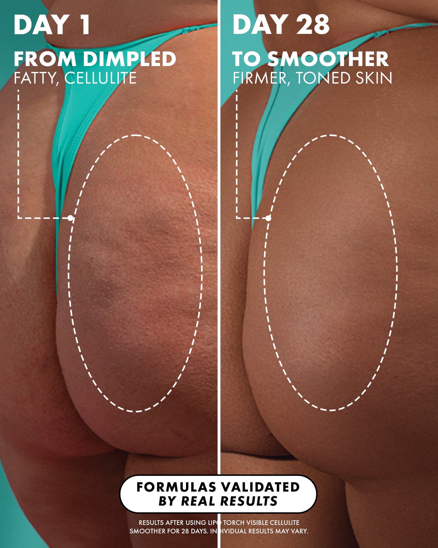 Lipo Torch Cellulite Serum - Truly