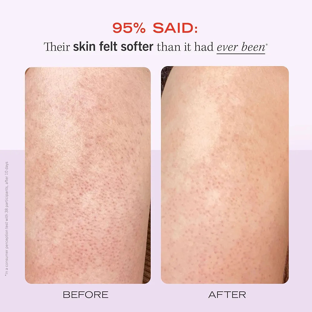 Bump Eraser Body Scrup with 10% Aha - First Aid Beauty