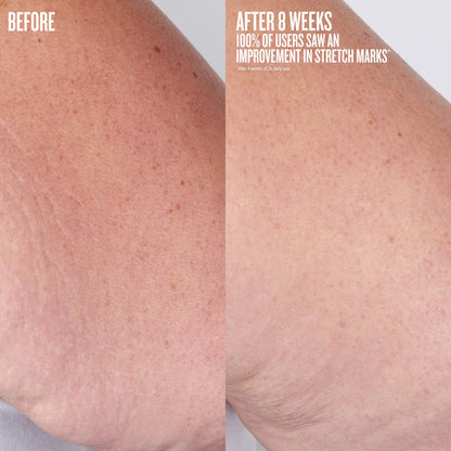 Beija Flor Elasti-Body Oil - Solo De Janeiro