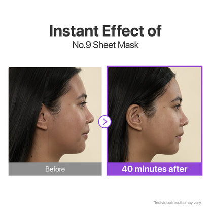 Nad+50 Peptides Lifting & Glowing Full Face Mask - Numbuzin
