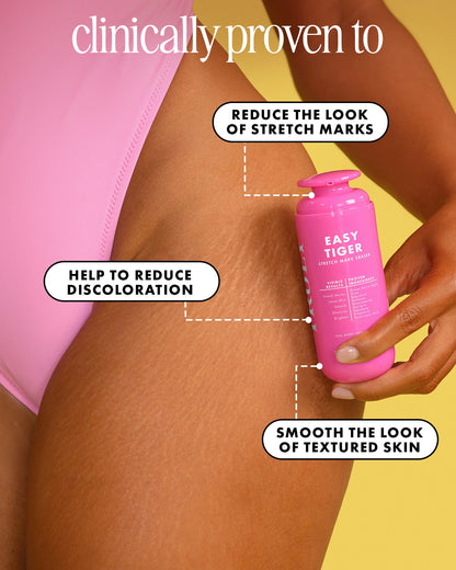 Easy Tiger Stretch Mark Eraser - Truly