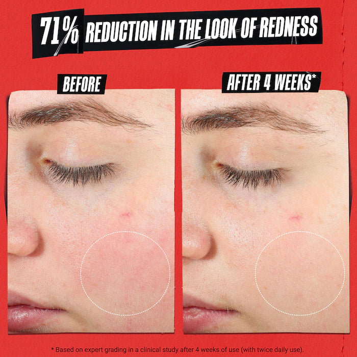 Ultra Facial Meltdown Recovery Cream[Medicated] - Kiehls