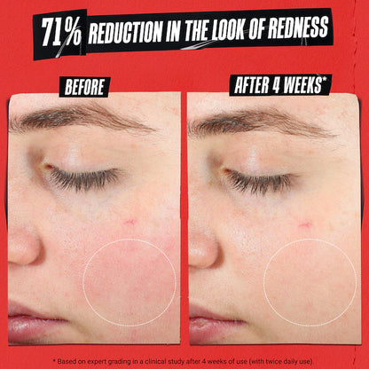 Ultra Facial Meltdown Recovery Cream[Medicated] - Kiehls