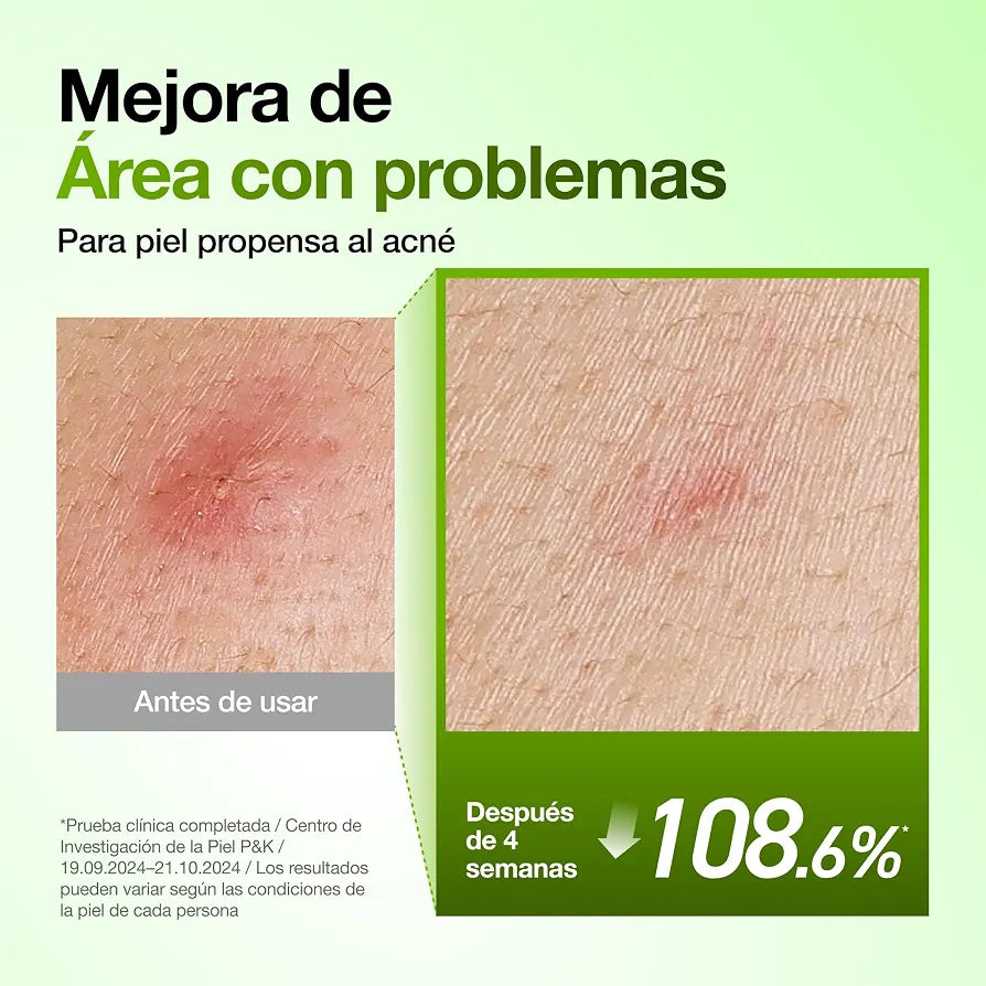 Azelaic Acid 10 Hyaluron Redness Serum -Anua