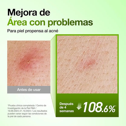 Azelaic Acid 10 Hyaluron Redness Serum -Anua