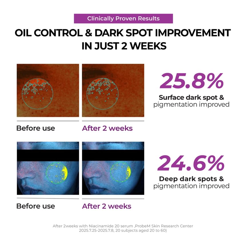 Niacinamide 2+Oil Control Cream - Jumiso
