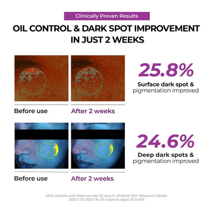 Niacinamide 2+Oil Control Cream - Jumiso