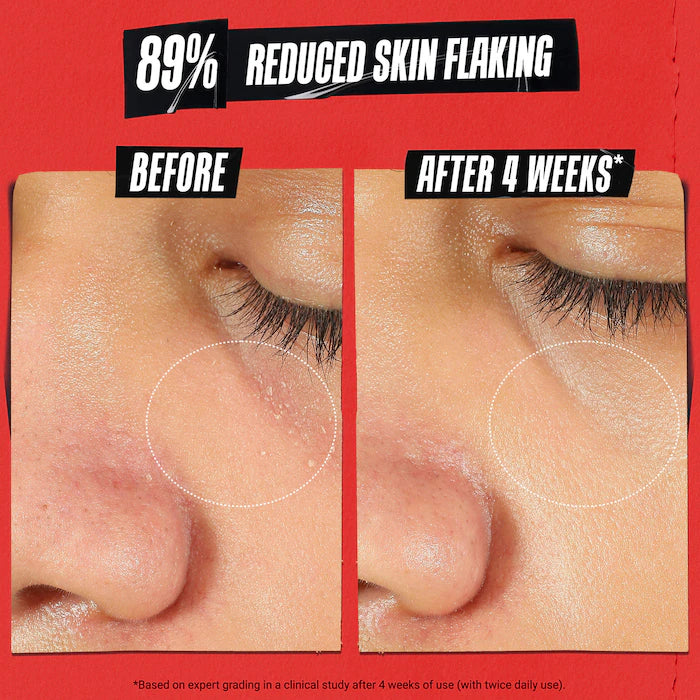 Ultra Facial Meltdown Recovery Cream[Medicated] - Kiehls