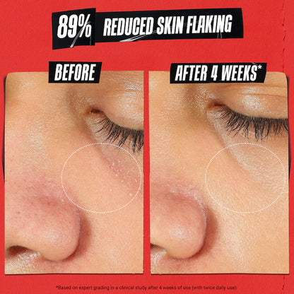 Ultra Facial Meltdown Recovery Cream[Medicated] - Kiehls