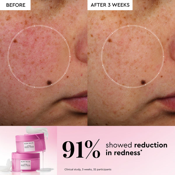 Toner Pads - Glow Recipe