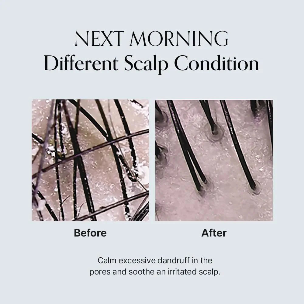 Damage Therapy Scalp Scaling Ampoule - Growus
