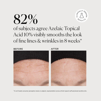Azelaic Topical Acid 10% - Naturium