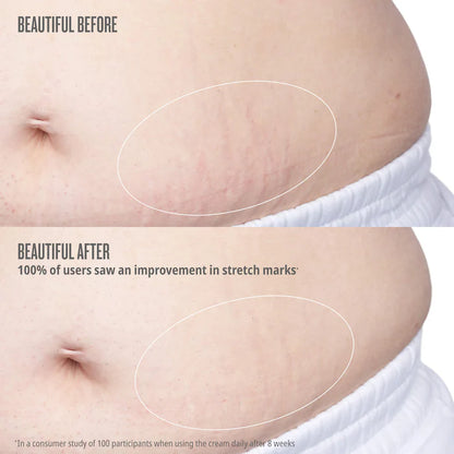 Beija Flor Elasti-Body Oil - Solo De Janeiro