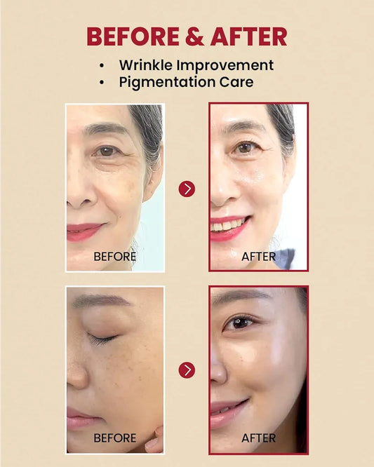 Seoul 1988 Serum Retinal Liposome 2%+Black Ginseng - K-Secret