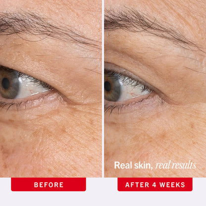 Ultra Repair Retinol Eye Cream - First Aid Beauty