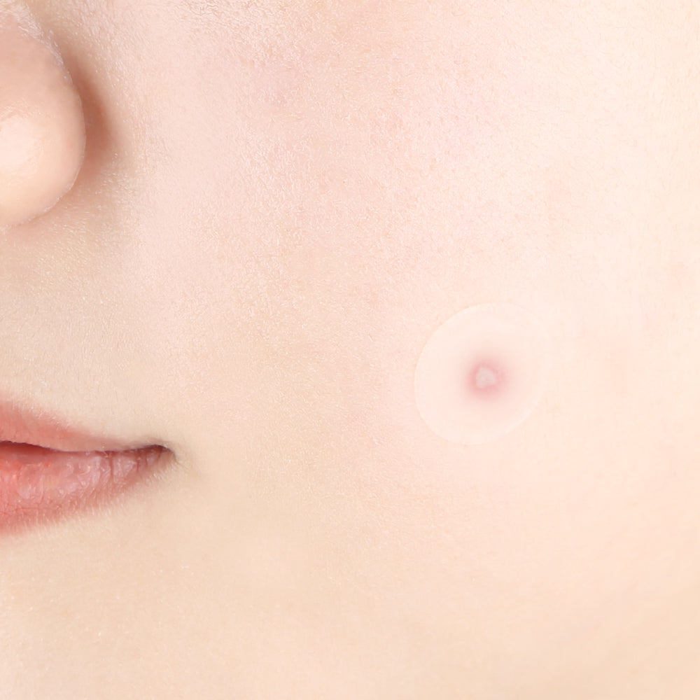 Clear Spot Patch - PyunKang Yul