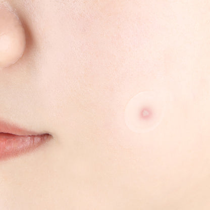 Clear Spot Patch - PyunKang Yul